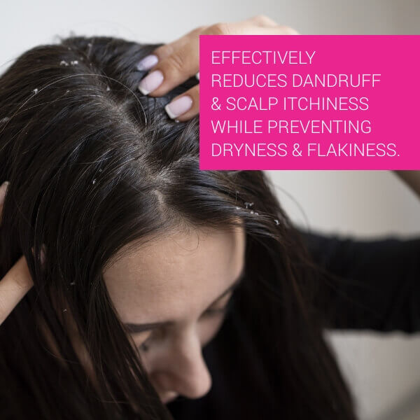 Scalp Renaissance Anti Dandruff Shampoo